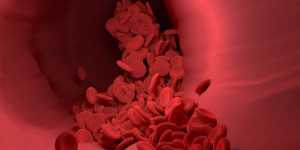 Arteroscleroza: curatarea arterelor in mod natural