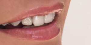 Tratamente simple pentru intarirea dintilor si a gingiilor in mod natural