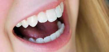 Tratarea abcesului dentar cu remedii naturale